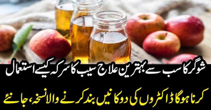 سیب کا سرکہ